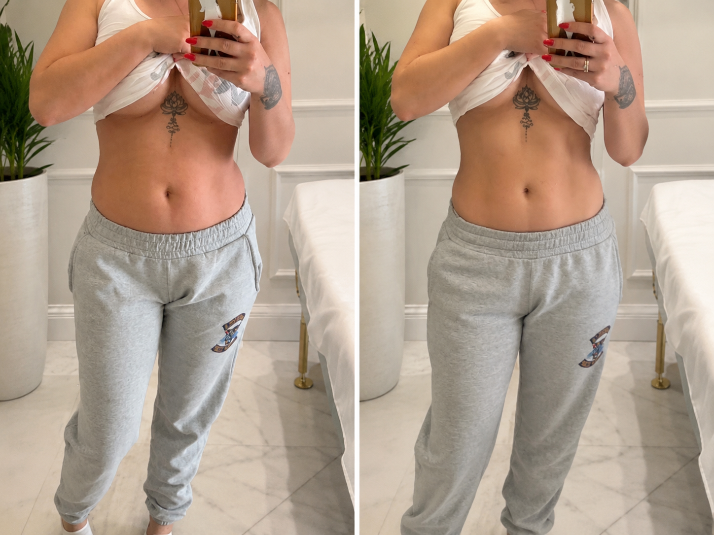 Metamorfoza brzucha i talii po zabiegach na ciało Contour Sculpt Pro
